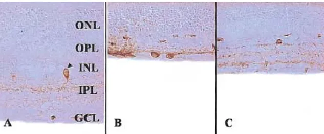 Fig. 9. Graphs  showing  the  mean  percentage  value  of  the  number  of  nNOS  immunoreactive  cells  (mean%±SD)  in  the  retinas  of  the  3  groups
