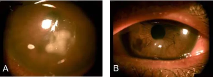 Fig. 2. Many  bacilli  with  gram-negative  staining  are  evident  in  the  culture  media