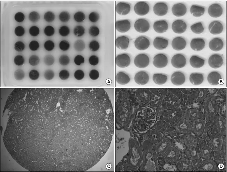 Fig. 1. A sample of tissue microarray (TMA). (A) 1:1 photography of a paraffin block and (B) a PAS-stained slide