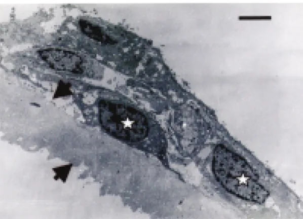 Fig. 2. Internal limiting membrane removed from the retina surrounding the macular hole