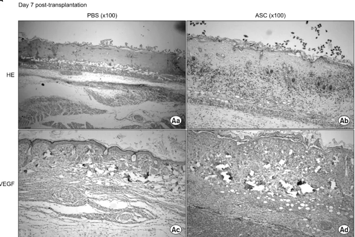 Fig. 6. Representative microphotographs comparing skin allograft specimens between phosphate buffered saline (PBS)-infused mice  and  adipose  tissue-derived  stem  cell  (ASC)-infused  mice  after  skin  allograft  transplantation