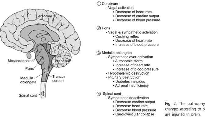 Fig. 2. The pathophysiological  changes  according  to  parts  which  are  injuried  in  brain.