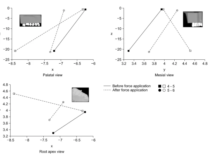 Fig 7. Displacement of the maxillary second molar according to mini-implant's position