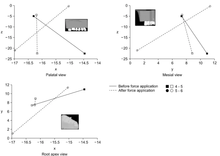 Fig 8. Graph representing displacement of the maxillary second molar (from the palatal cusp tip to the palatal root apex, magnification x 50)