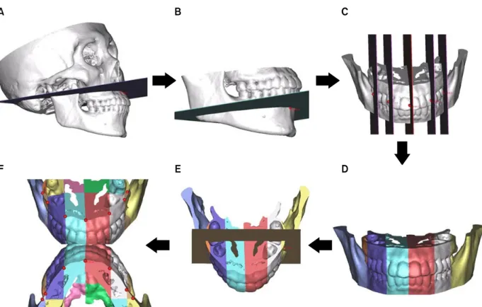 Fig 2. Basal bone. A, A plane passing through A point parallel to XY plane; B, a plane passing through B point paral- paral-lel to XY plane; C, five planes passing through the FA points of #16, #13, center of #11 and 21, #23, and #26 paralparal-lel to YZ p