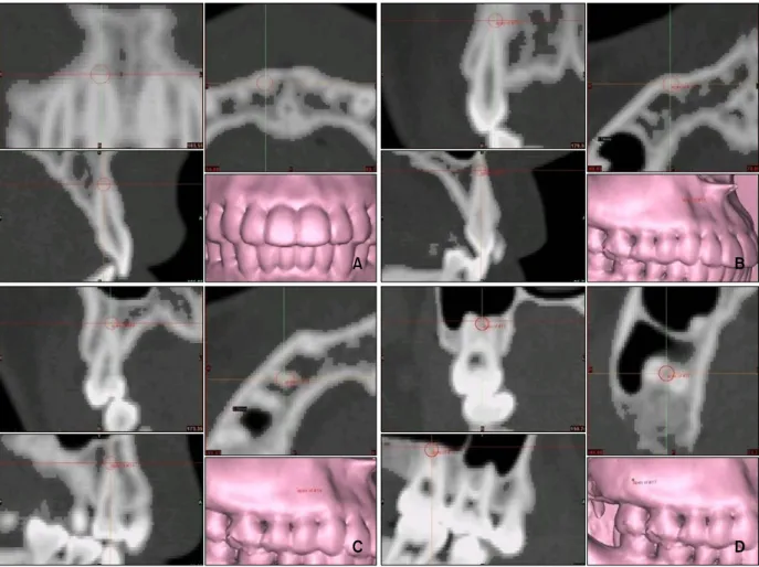 Table 2. Comparison of basal bone between right and left sides (unit: mm)