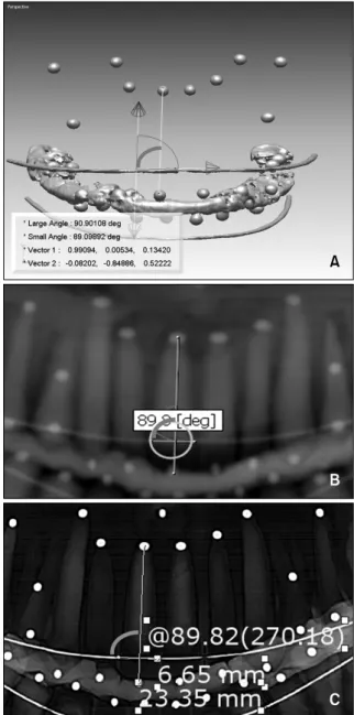 Fig 3. Angular measurement of tooth axis to reference line.  A, CBCT 3D image; B, CBCT-generated  pan-oramic view; C, panpan-oramic radiograph