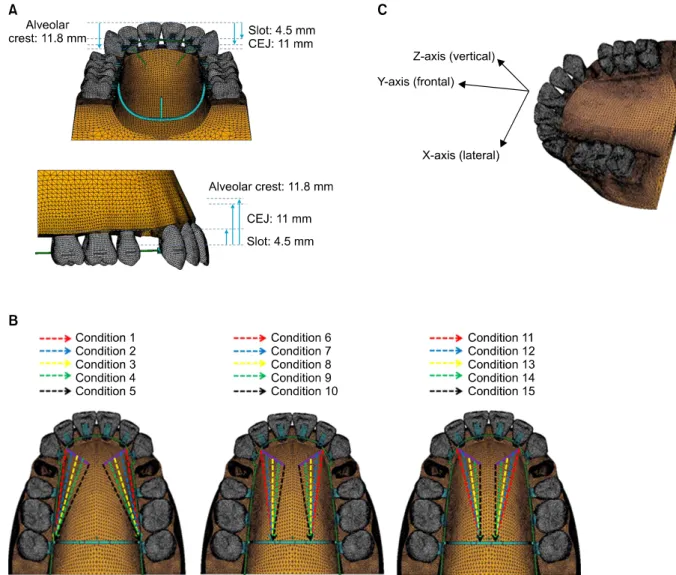 Fig 1.  A, Three-dimensional finite element model for upper teeth, periodontal ligaments and alveolar bones; B, ex- ex-perimental groups are divided into three groups depending on the position of retraction: position of retraction arm  in the first group i