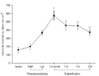 Fig . 1. Cha nge in P a O2 during s e que ntia l bila te ra l lung tra ns pla nta tion.