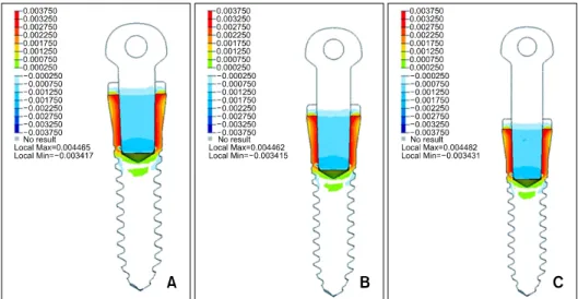 Fig 4. Stress distribution generated by friction fitting between the head part and screw part of the mini-implant