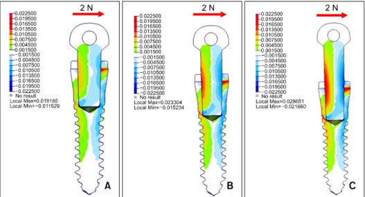 Fig 5. Contour plots of signed von Mises stress generated by mini-implants having head lengths of 1 mm (A), 2 mm (B), and 3 mm (C) after a 2 N lateral force is applied.
