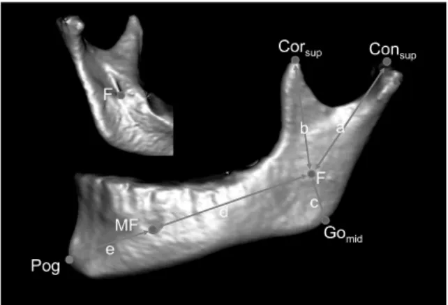 Fig 1. Landmarks and measurements used in this  study. A, condylar unit length; b, coronoid unit length;