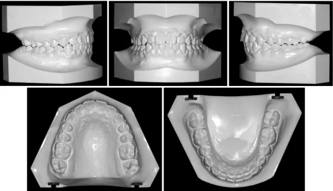 Fig 9. Postreatment dental casts of the case.