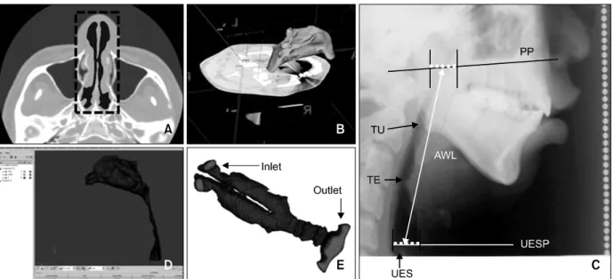 Fig 1. Construction of 3D upper airway. A, Segmentation of the air region. The black color in the dotted box shows the nasal cavity; B, 3D surface model