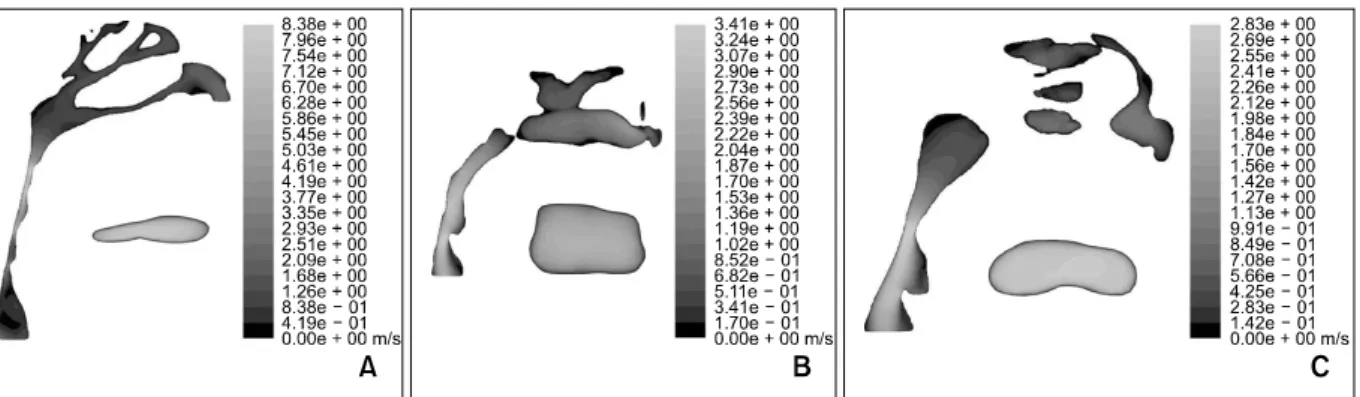 Fig 5. Comparison of the changes of the airflow velocity at the flow rate of 200 ml/s
