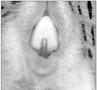Fig 1. Bite-jumping appliance in place for anterior for- for-ward movement. 