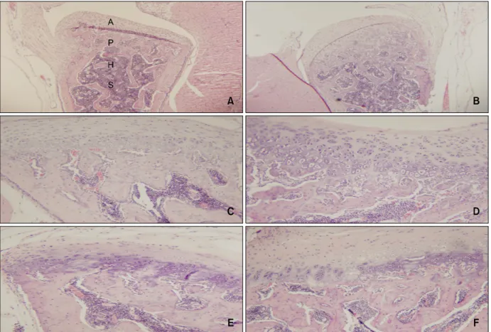 Fig 3. Comparison of histologic changes in the condyle between the control group and experimental groups according to the appliance wearing time (H&amp;E stain, × 40)