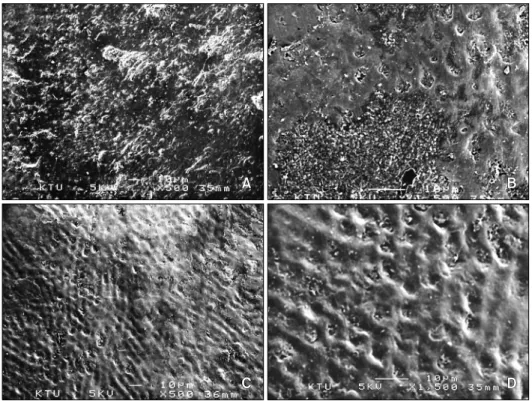 Fig 2. Scanning electron micrographs of erupted (A, × 500; B, × 1,500) and unerupted (C, × 500; D, × 1,500) molar  teeth.