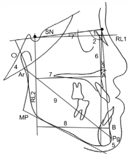 Fig 1. Skeletal measurements used in the study. SN in- in-dicates Sella-nasion plane; RL1, horizontal reference  line; RL2, vertical reference line; 1, SNA; 2, SNB; 3,  ANB; 4, SN-MP; 5, Pg-NB; 6, A-RL1; 7, A-RL2; 8,  B-RL2; 9, Ar-Pg.