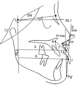 Fig 2. Dental measurements used in the study. SN in- in-dicates Sella-nasion plane; RL1, horizontal reference  line; RL2, vertical reference line; 1, U1-SN; 2, L1-MP; 