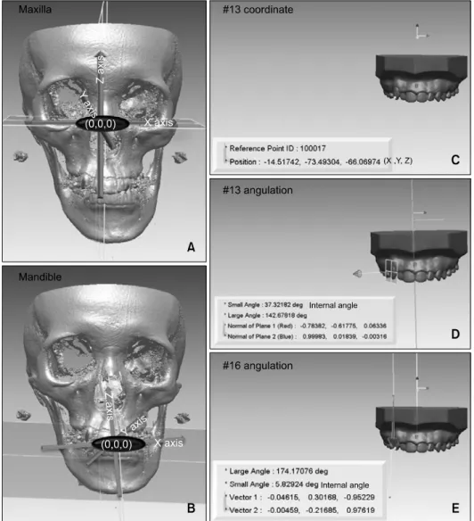 Fig 2. Reference coordinates and measurements. A, Maxilla, FH plane was constructed by connecting both sides of Po and right of Or
