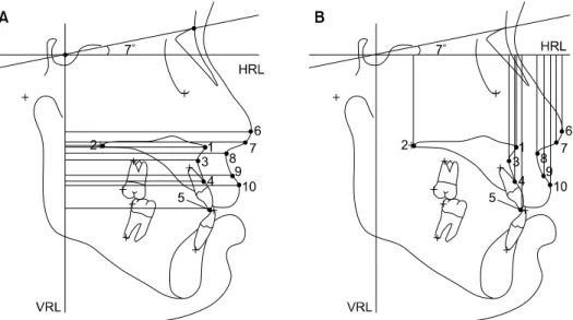 Fig 2. Horizontal and vertical linear measurements. HRL, Horizontal reference line; VRL, vertical reference line; A, 1, ANS to VRL; 2, PNS to VRL; 3, A point to VRL; 4, supradentale to VRL; 5, upper incisor edge to VRL; 6,  prona-sale to VRL; 7, columella 