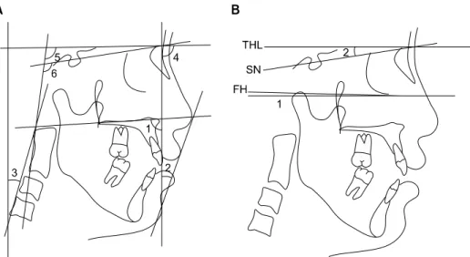 Fig 5. Angular measurements. A, 1, Nasion true vertical line (NTVL) to palatal plane; 2, NTVL to E-Line; 3, NTVL to cervical vertebrae tangent; 4, NTVL to sella-nasion (SN); 5, true horizontal line (THL) to odontoid process tangent (OPT); 6, SN to OPT