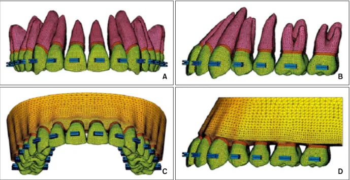 Fig 1. Three-dimensional finite element mesh of tooth-periodontal ligament (PDL)-alveolar bone of the maxillary  dentition
