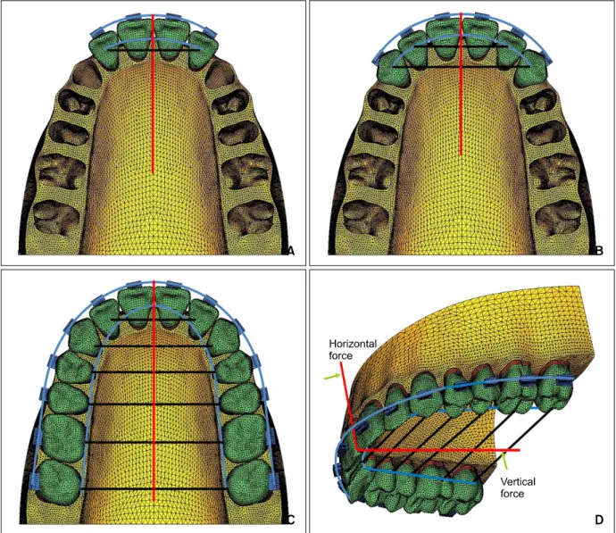 Fig 3. Finite element models of the teeth group. A, Four anterior teeth; B, six anterior teeth; C, full maxillary dentition.
