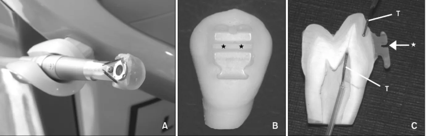 Fig 1.  A, Laser delivery device with laser focusing guide; B, lasing point (★);  C, tooth cross-section