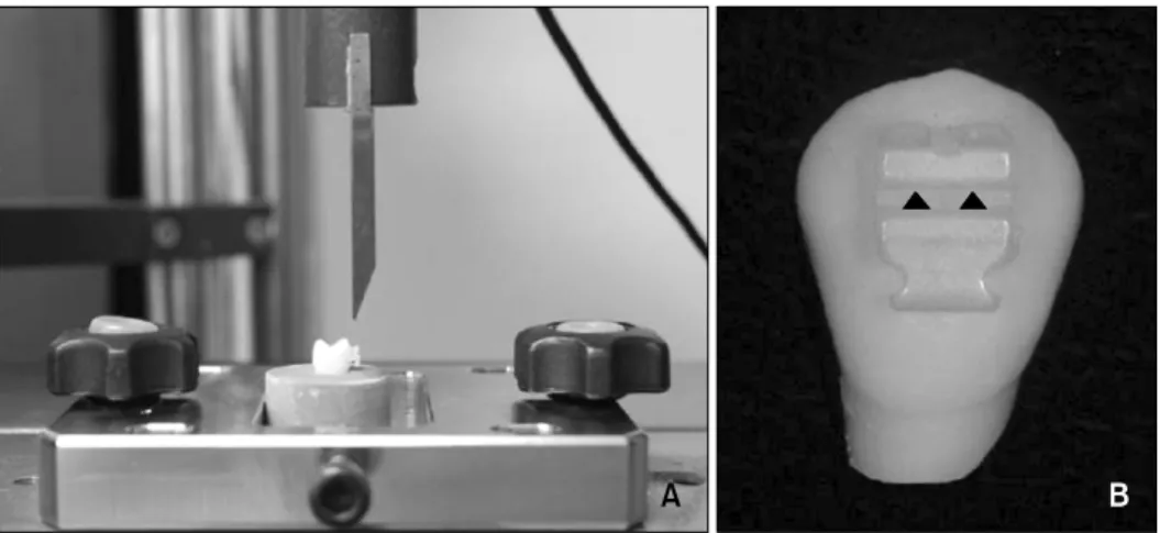 Fig 1.  A, Experimental set-up for shear bond strength measurement; B, lasing positions (▲)