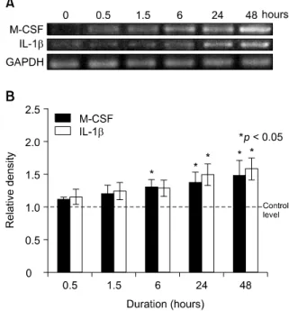 Fig 2. Compressive stress up-regulated M-CSF and  IL-1β mRNAs expression in PDL cells