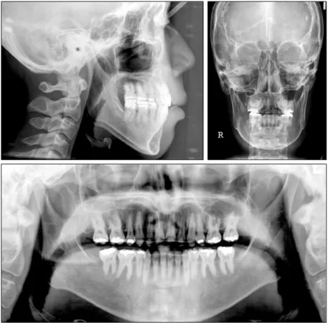 Fig 8. Post-treatment radiographs.