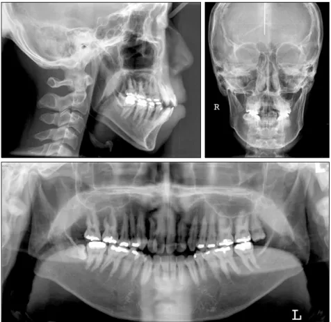 Fig 2. Pretreatment radiographs.