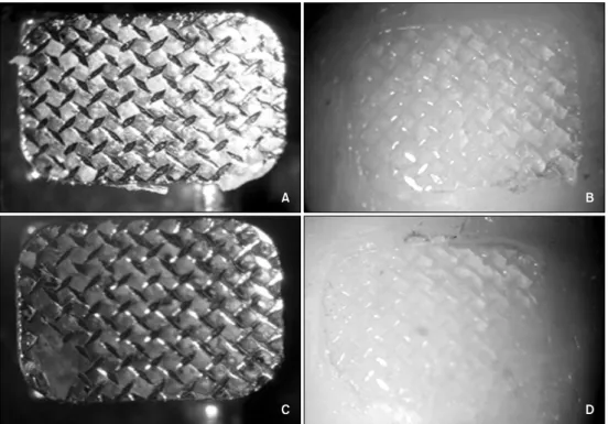 Fig 1. Examples of assignments of adhesive remnant index scores (with 10 × magnification)