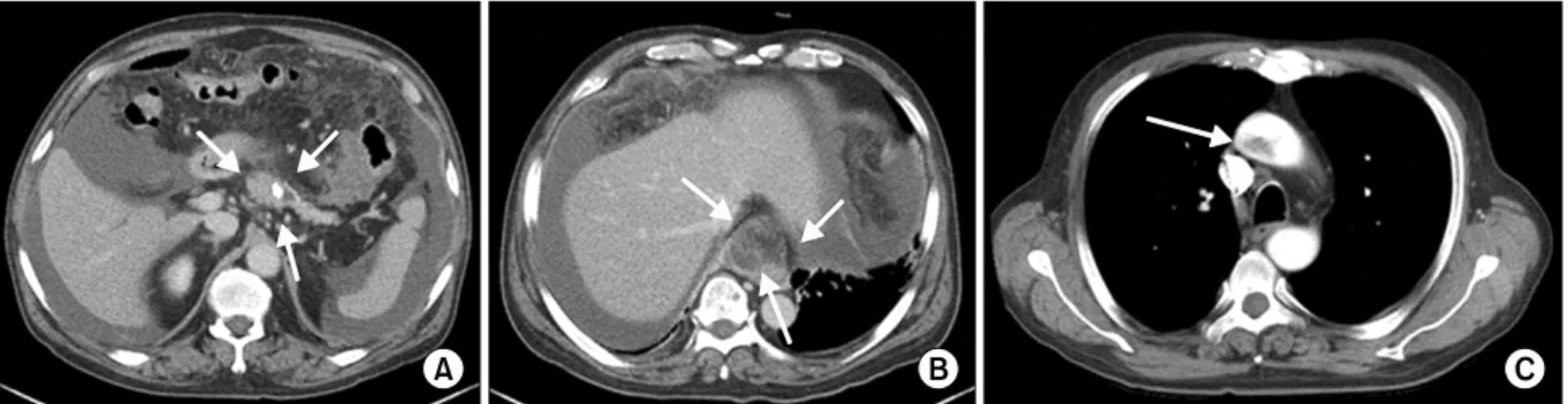 Fig. 1. Axial view of abdominal and chest contrast-enhanced computed tomography on admission