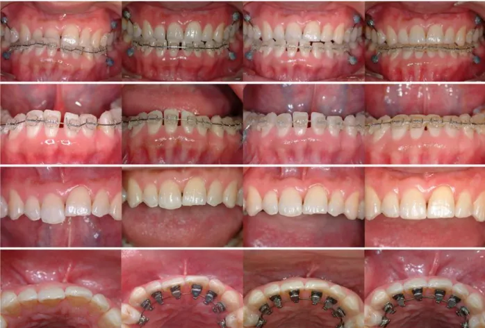Fig 6. Treatment progress.