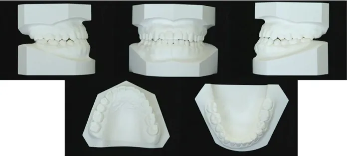 Fig 9. Posttreatment dental casts.