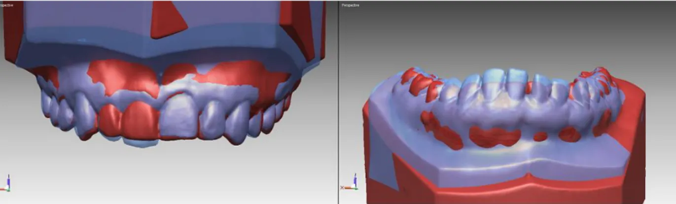 Fig 13. 3D-Model superimposition.