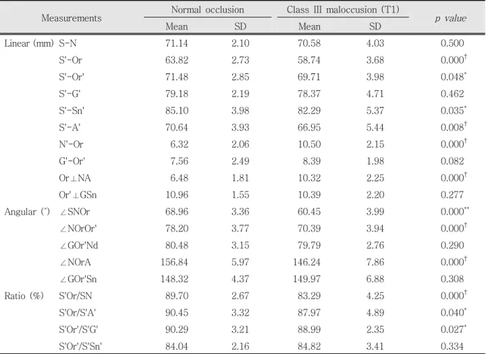 Table 2. Comparison of the mean values of soft tissue and skeletal tissue variables between skeletal Class Ⅲ patients (T1) and normal occlusion in the previous report by Lee and Chung 22 (female)