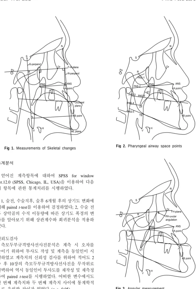 Fig 2. Pharyngeal airway space points