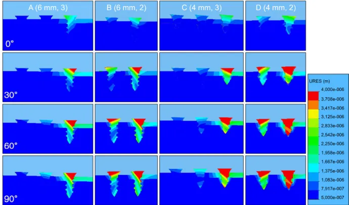 Fig  3. Displacement distributions of all models (A-D). 10.520μm,  10.810μm로  나타났다.  또한  C  모델에 서는 각각 2.659μm,  6.856μm,  9.566μm,  9.851μm 로 나타났으며,  D  모델에서는 각각 3.636μm,  9.391 μm,  12.800μm,  13.050μm로 나타났다 (Table  5)