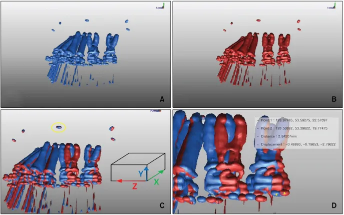 Fig  4. Superimposition and measurement using Rapidform 2004 TM .  A, Before tooth movement; B, after tooth move- move-ment;  C, sagittal view of superimposition before and after experiment