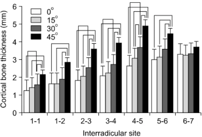 Fig  8. Mean value of root proximity in the mandible. 1,  Central incisor; 2, lateral incisor; 3, canine; 4, first  pre-molar; 5, second prepre-molar; 6, first pre-molar; 7, second  molar.구치-제1대구치  사이는  45o의  각도를  부여했을  때 피질골 두께가 유의하게 증가하였고 그 이하의 각도에서는 유의한