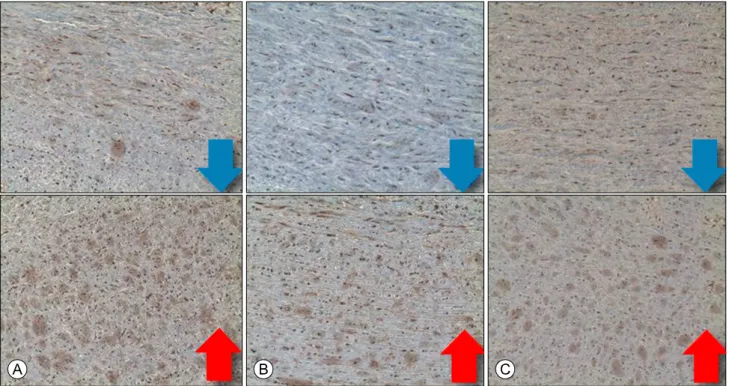 Fig. 1. Typical findings of immunohistochemistry staining for target molecule expression