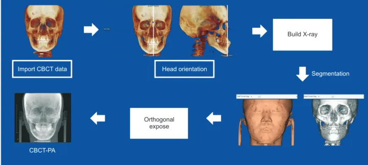 Figure 1. Flow diagram showing the processing of the cone-beam computed tomography (CBCT)-synthesized posteroan- posteroan-terior (PA) cephalograms