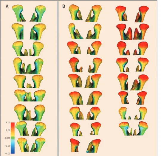 Figure 7. The posterior view  of all condylar  superimposi-tions in the contol (A) and  experimental (B) groups (CG  and EG, respectively)