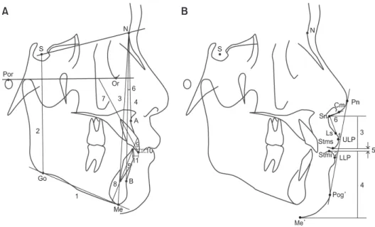 Figure 1. Landmarks, reference planes, and measurements in cephalometric analyses. 