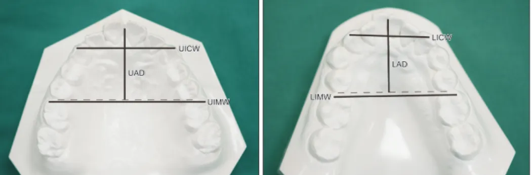 Table 3). MLF significantly increased from T0 to T1 in  the extraction group (3.25 N, p < 0.01), and this  in-crease was significantly greater than that (0.69 N) in the  nonextraction group (p < 0.05; Table 3)