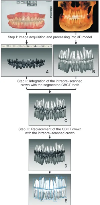 Figure 4. Construction procedure of the individual  composite tooth models. A, Intraoral-scanned crown